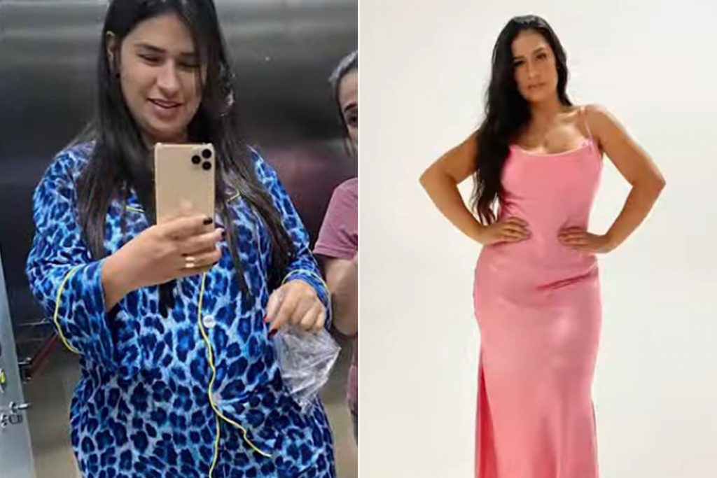 Simone Mendes Mostra Antes E Depois Ap S Perder Quilos