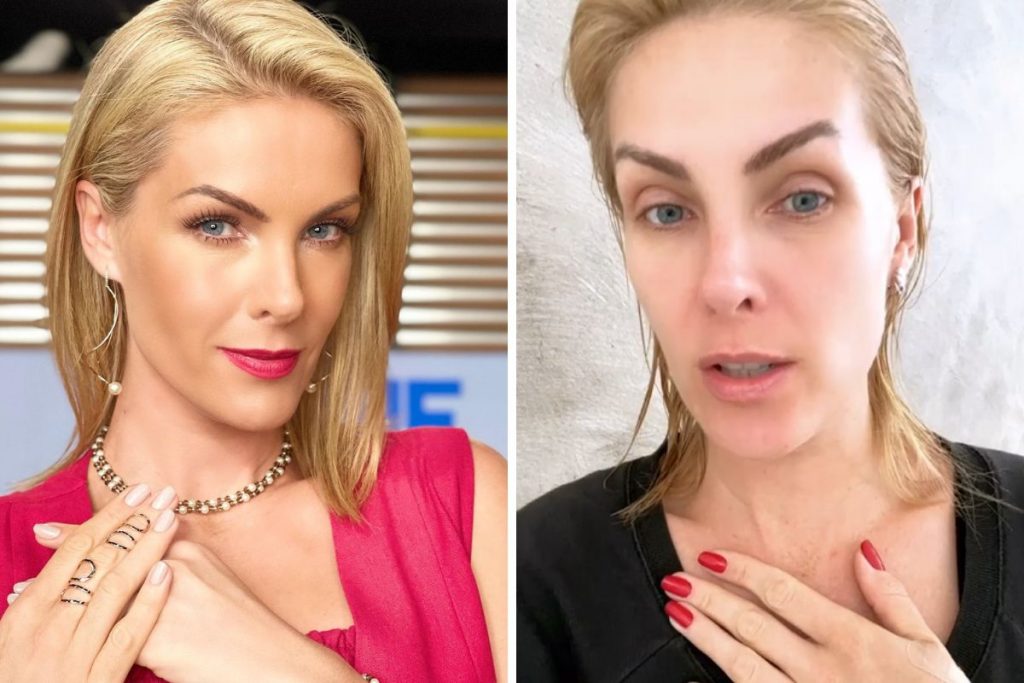 Ana Hickmann sofre acidente doméstico e tem corte profundo na mão