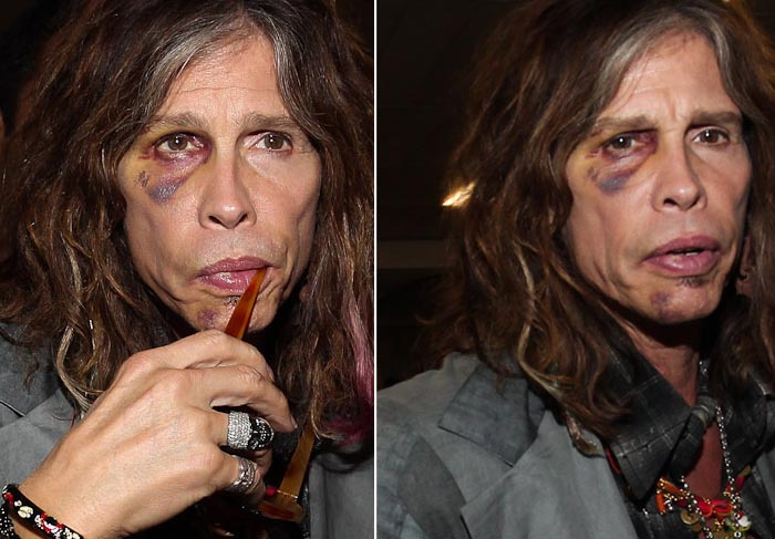 Cheio de hematomas, Steven Tyler desembarca em São Paulo com a namorada  O Fuxico