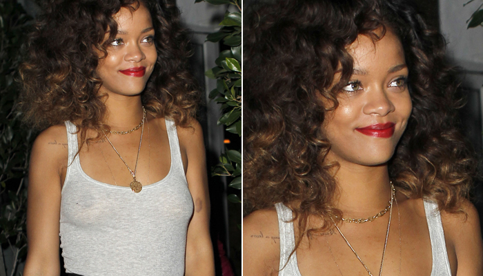 Rihanna aparece com seios à mostra e hematoma no braço