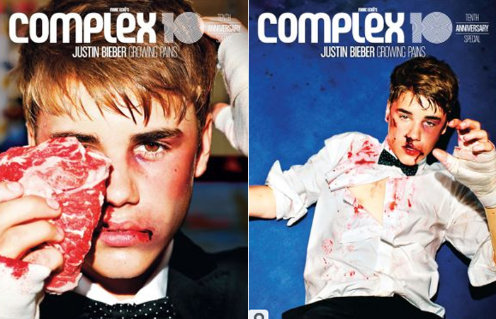 Justin Bieber leva “surra” em capa de revista