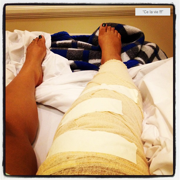 Preta Gil posta foto no Twitter de sua perna operada 