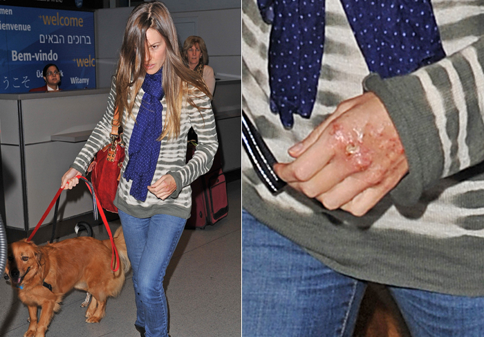 Hilary Swank chega a NY com seus cachorros e a mão ferida