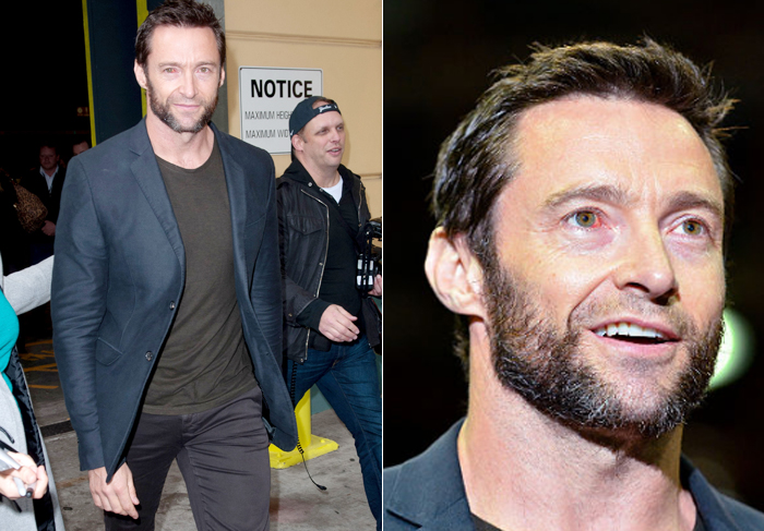 Hugh Jackman aparece com olho vermelho em coletiva