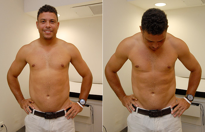 Veja o antes e o depois de Ronaldo no Medida Certa