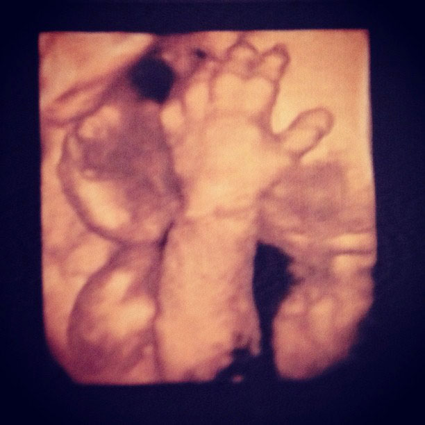 Grávida de seis meses, Juliana Paes mostra o ultrassom do filho