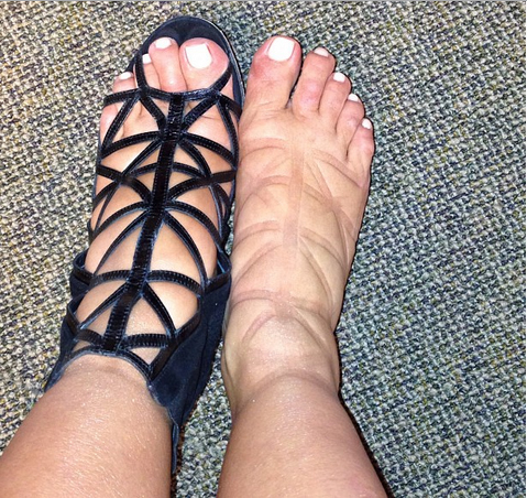 Kim Kardashian mostra marca nos pés por causa de sapatos apertados