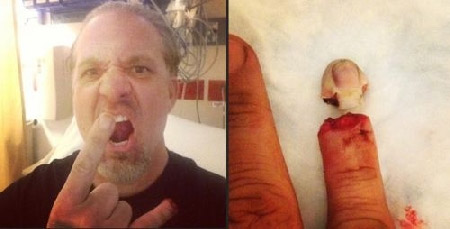 Ex-marido de Sandra Bullock perde o dedo em acidente e mostra foto no Twitter