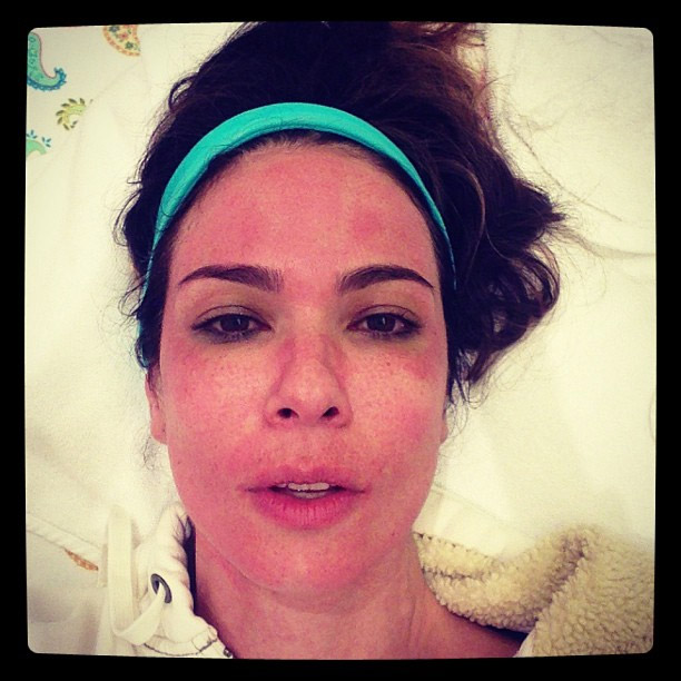 Luciana Gimenez fica com o rosto marcado após tratamento de beleza