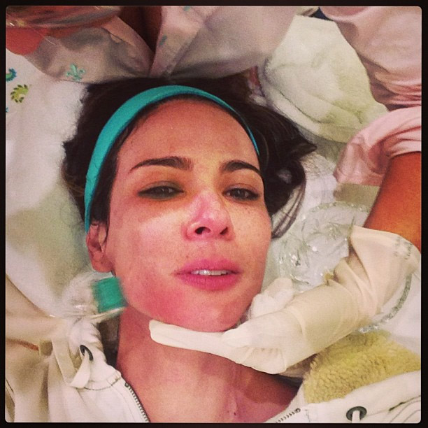 Luciana Gimenez fica com o rosto marcado após tratamento de beleza