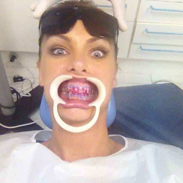 Ana Hickmann vai ao dentista e posta foto com o bocão aberto