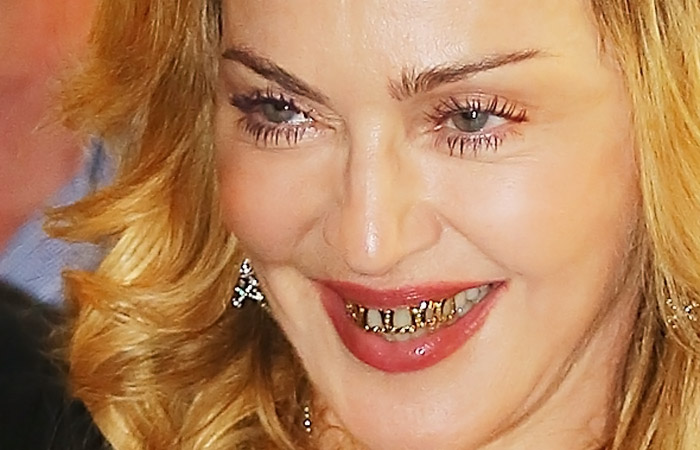 Madonna exibe prótese de diamantes nos dentes, em Roma