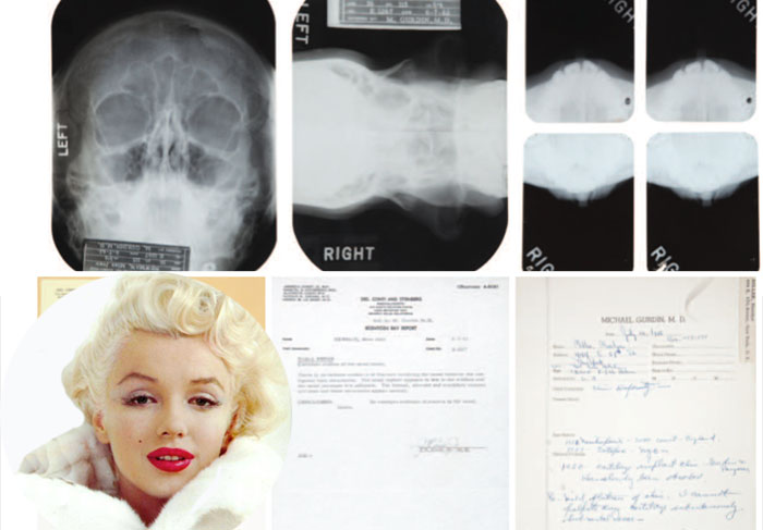 Raio-X prova que Marilyn Monroe fez plástica nos anos 50