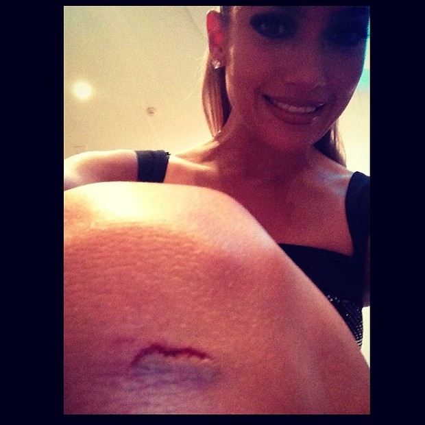Jennifer Lopez se machuca durante apresentação, mas tranquiliza fãs
