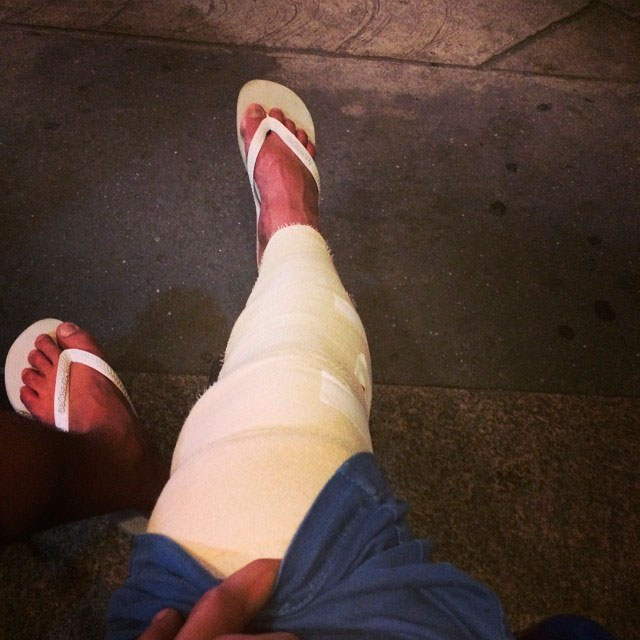 Bruno de Luca se acidenta e rompe ligamentos do joelho