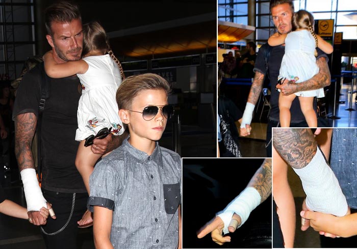 David Beckham surge de braço enfaixado em Los Angeles