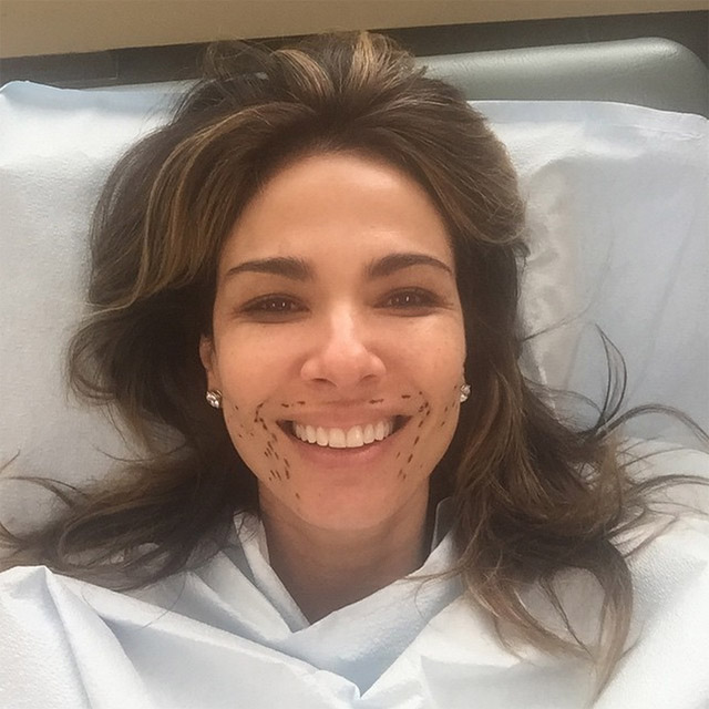 Luciana Gimenez faz tratamento com o próprio sangue no rosto