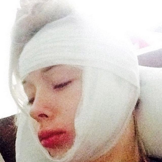 Valeria Lukyanova, a Barbie humana, é brutalmente agredida na porta de sua casa 
