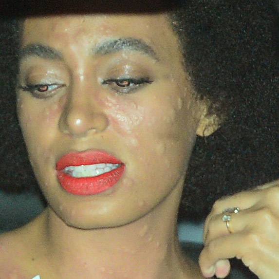 Veja como ficou o rosto de Solange Knowles após sofrer reação alérgica