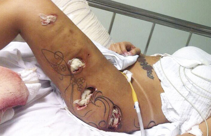 Fotos de Andressa Urach ainda no hospital são divulgadas