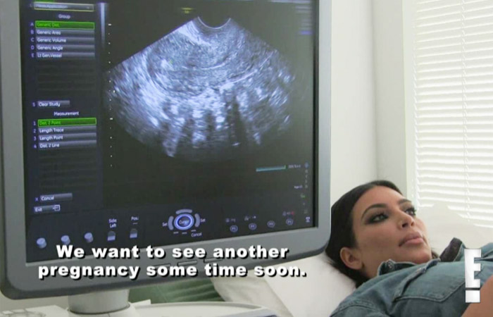 Kim Kardashian discute e diz que 'comprou' carreira de modelo da irmã Kendall