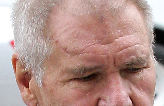 Durante passeio, Harrison Ford exibe hematomas na testa