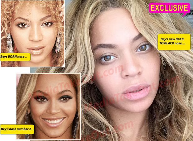 Site diz que Beyoncé volta a ter nariz 'achatado'