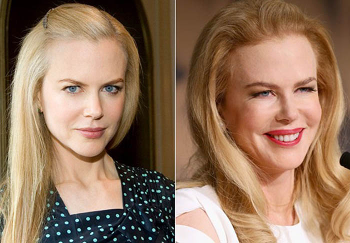 Nicole Kidman, estrela de filmes como A Rainha do Deserto e Grace de Mônaco