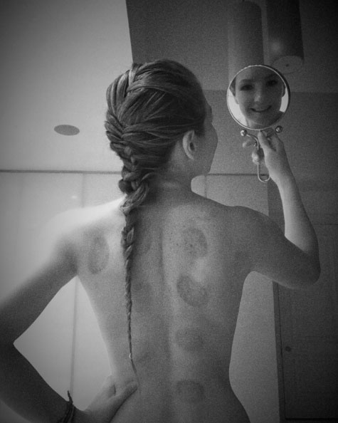 Thalia faz topless para mostrar resultado de tratamento