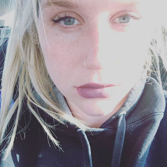 Kesha quebra o silêncio em foto: 'Rosto inchado de lágrimas'
