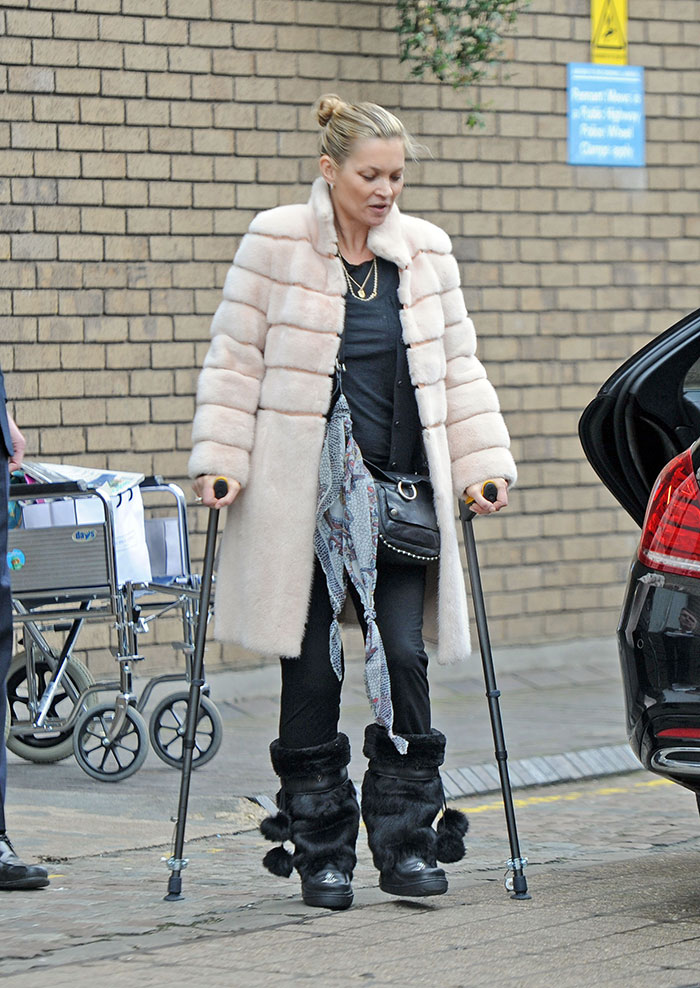 Kate Moss usa muletas após sofrer acidente
