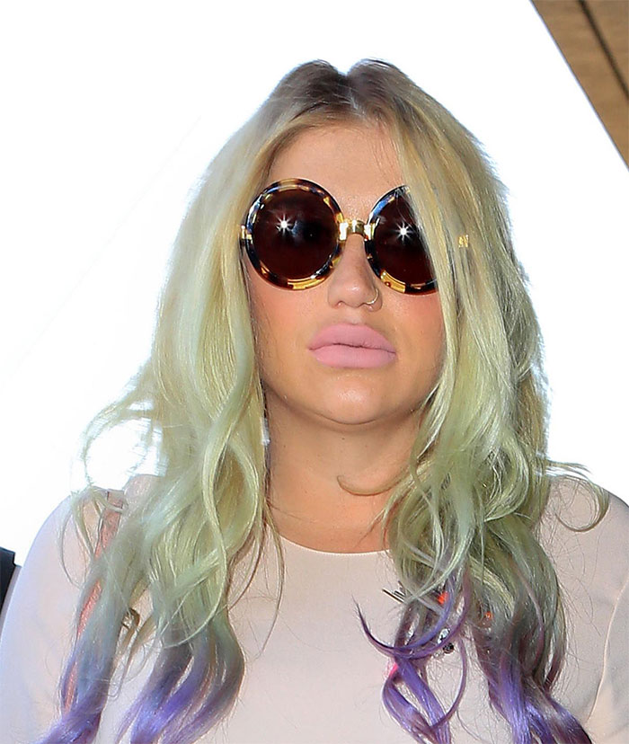 Exagerou! Kesha aparece com lábio enorme em L.A