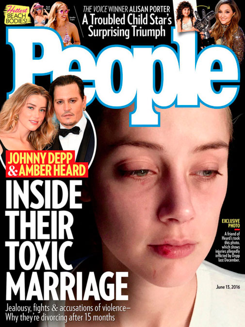 Revista expõe foto inédita de Amber Heard machucada na capa