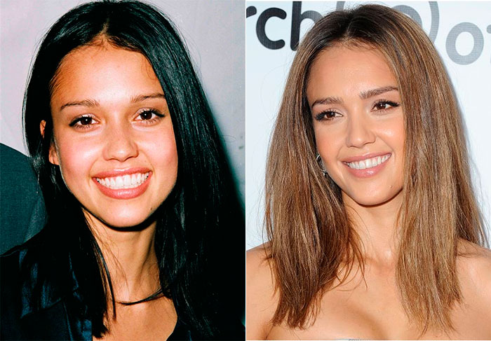 Jessica Alba é mais uma das personalidades que impressionam por não parecer que elas envelhecem. No início dos anos 2000, ela iniciava sua carreira de sucesso em Hollywood e, apesar de um casamento, dois filhos, ela pareceu só ter perdido a carinha de adolescente, mas é mais um que está no formol