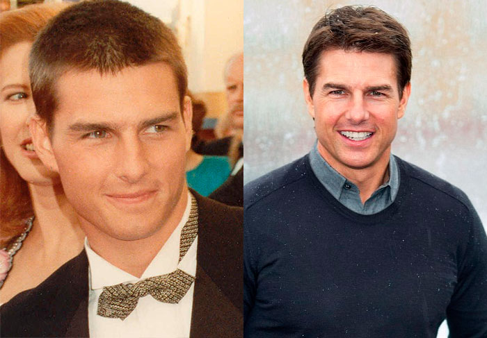 Tom Cruise está no time dos Homens Imortais. Escolhemos uma foto dele no Oscar de 1990 e nos últimos anos com pouco mais de 50 anos. Tirando o estilo, a carinha de adolescente e o visual dos cabelos, mudou mais alguma coisa? Isso que o ator vive trabalhando pelo mundo afora, passou por dois casamentos e parece que nada disso o afetou para envelhecer