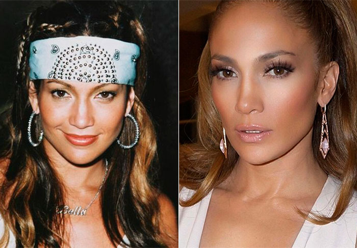 Pode-se dizer que Jennifer Lopez passou por tratamentos estéticos, tem os melhores produtos do mundo aos seus pés, mas ela não iria conseguir o corpo e o rosto que tem hoje sem uma boa genética