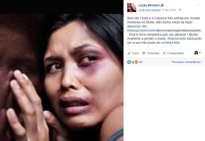 Luiza Brunet denuncia ex-namorado por agressão.
