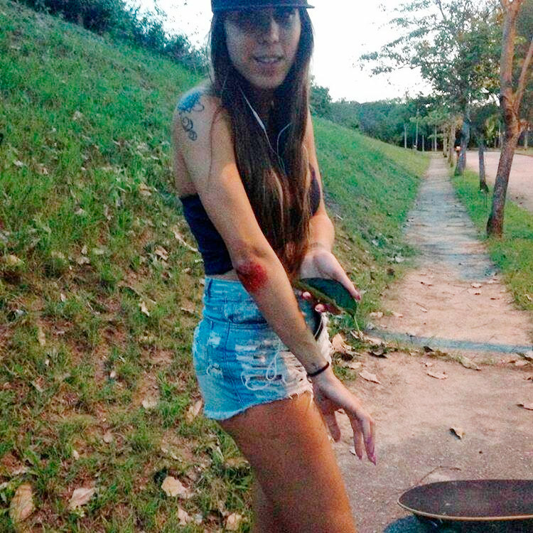 Musa do Tatuapé, Gabi Miranda, se machuca de skate