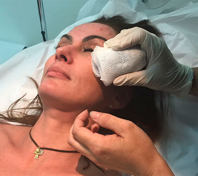 Núbia Oliiver afirma: ‘Não vivo sem botox’