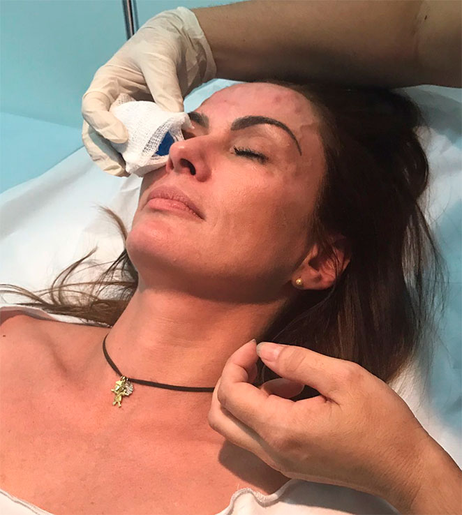 Núbia Oliiver afirma: ‘Não vivo sem botox’