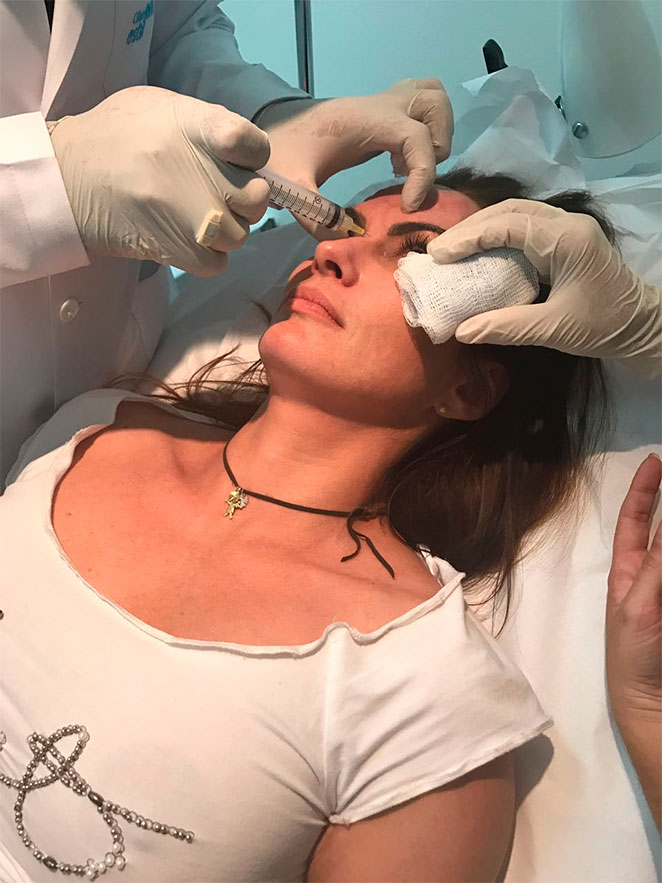 Núbia Oliiver afirma: ‘Não vivo sem botox’