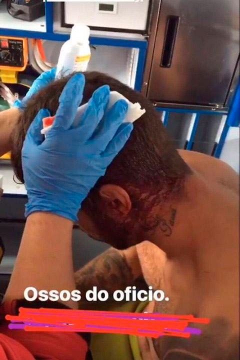 Pedro Scooby machuca a cabeça surfando em Portugal 