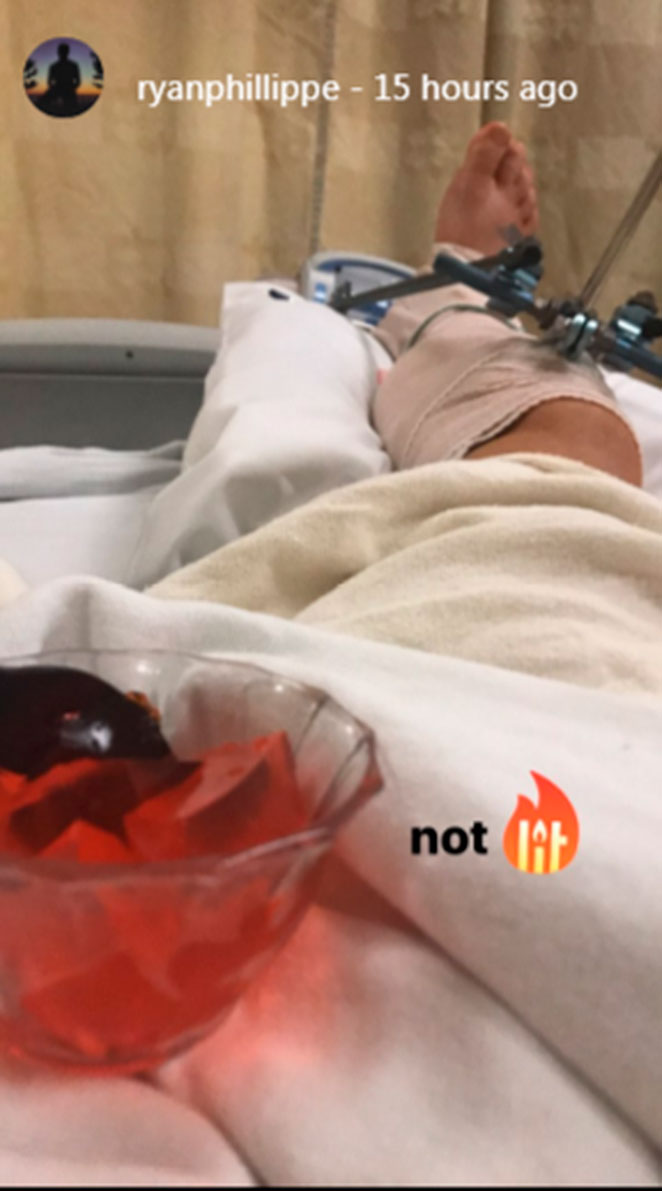Ator de Hollywood quebra a perna e mostra no Instagram