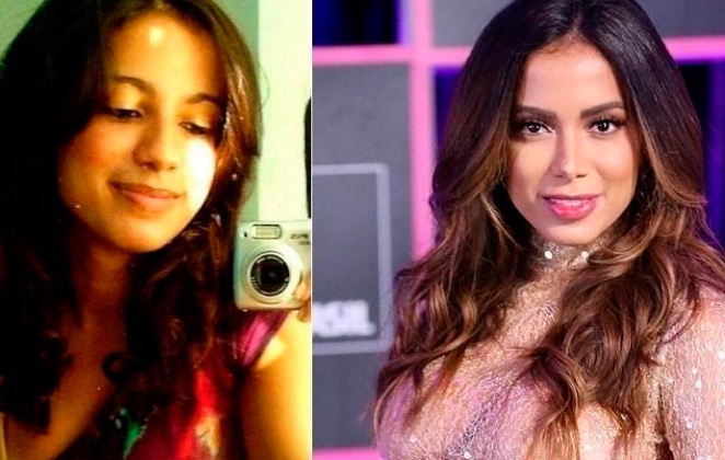 Anitta brincou nas redes sociais ao comparar duas fotos, em idades diferentes