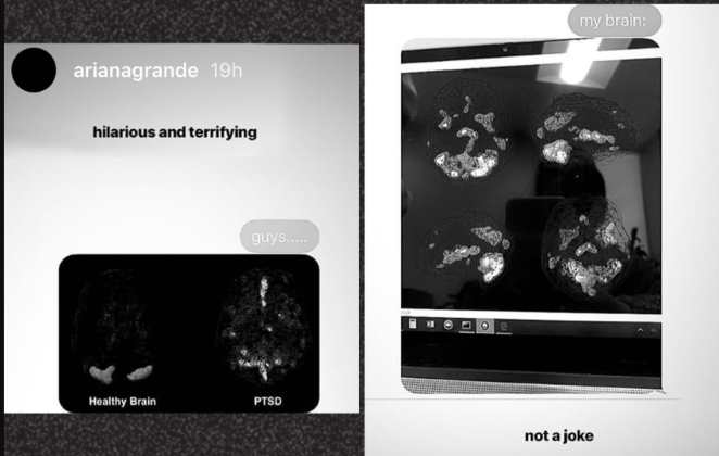 Ariana Grande mostrou tomografia e assustou os fãs