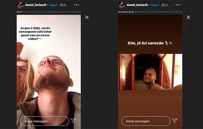 Ex-BBB Daniel Lenhardt mostrou no Instagram que já teve cabelo raspado no passado