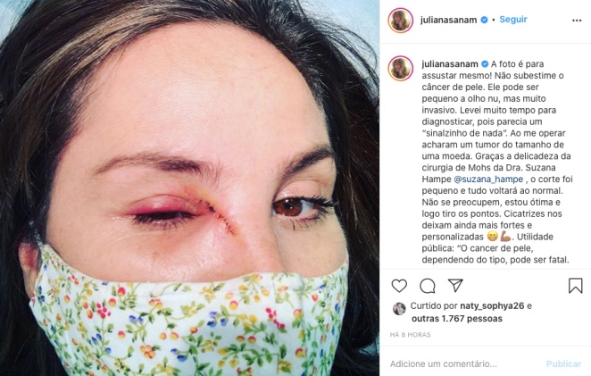 Juliana Sana choca seguidores com foto de cicatriz