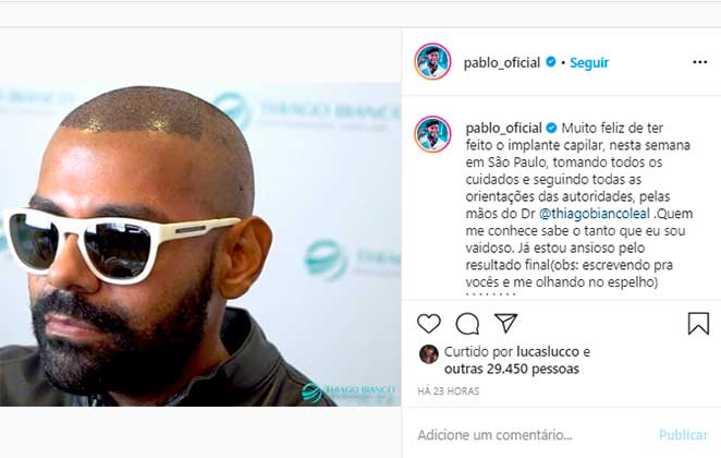Pablo compartilhou com seus seguidores do Instagram a felicidade em ter realizado o transplante capilar