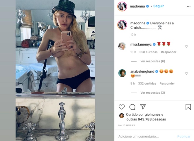 Madonna posa de topless e muleta