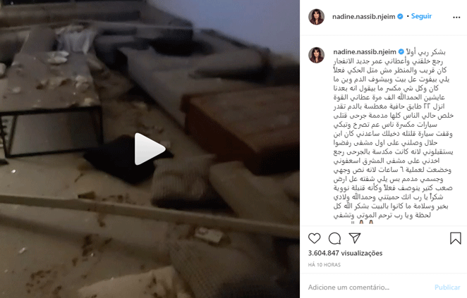 Nadine Nassib Njeim, ex-miss Líbano, passa por cirurgia de seis horas